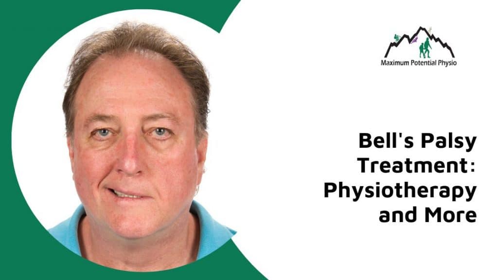 Physiotherapy and Bell's Palsy Treatment