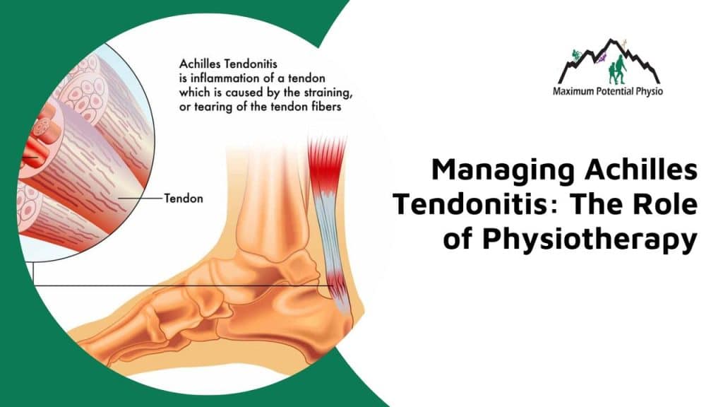 physiotherapy for achilles tendonitis calgary nw