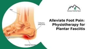 physiotherapy for plantar fasciitis calgary nw