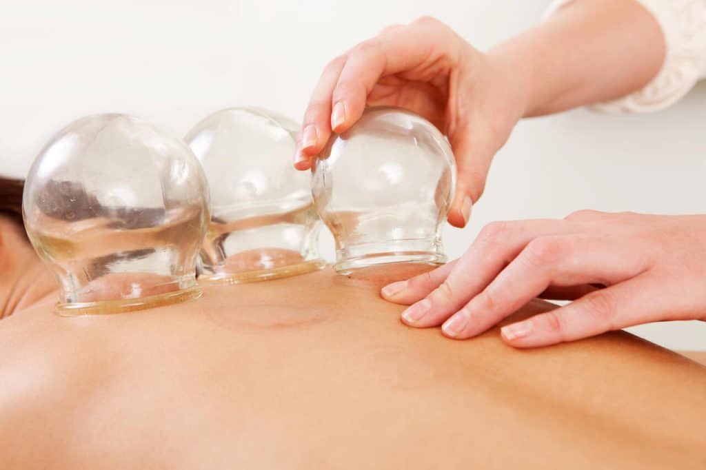 benefits of cupping therapy