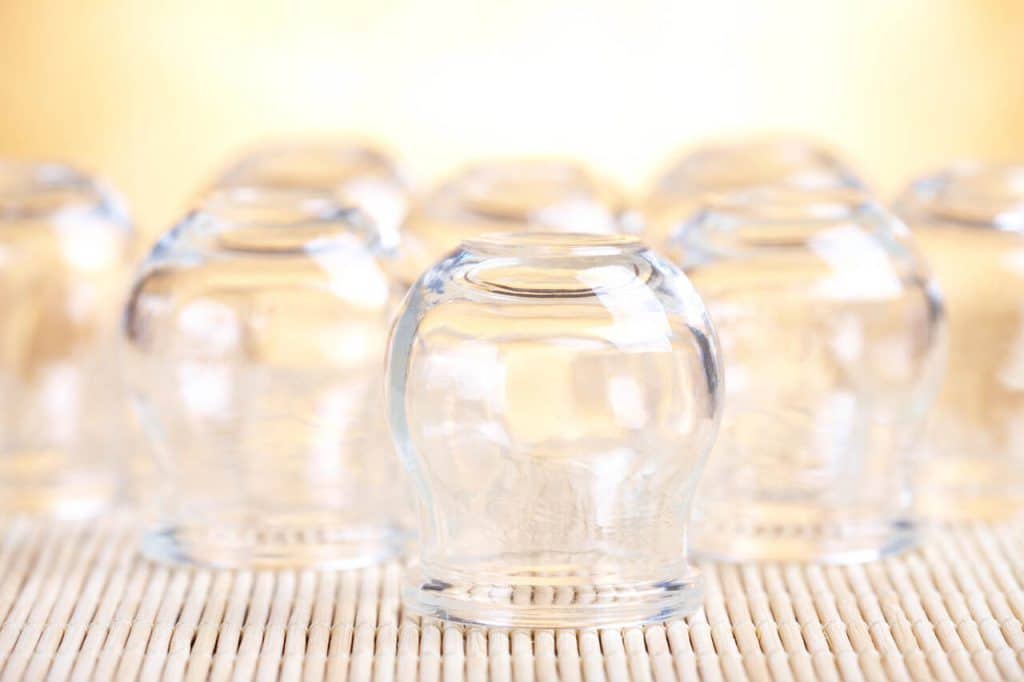 cupping therapy for pain relief